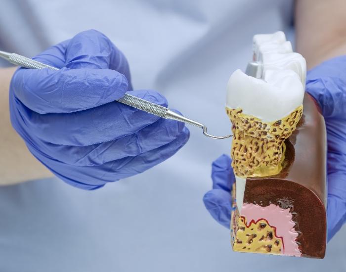 Alternative Treatment for Gum Disease in Houston: Effective Non-Surgical Options for Healthier Gums
