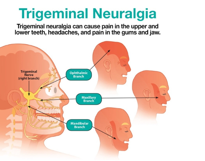 Tooth Pain But No Cavity — What Is Really Causing It? A Houston Patient Guide