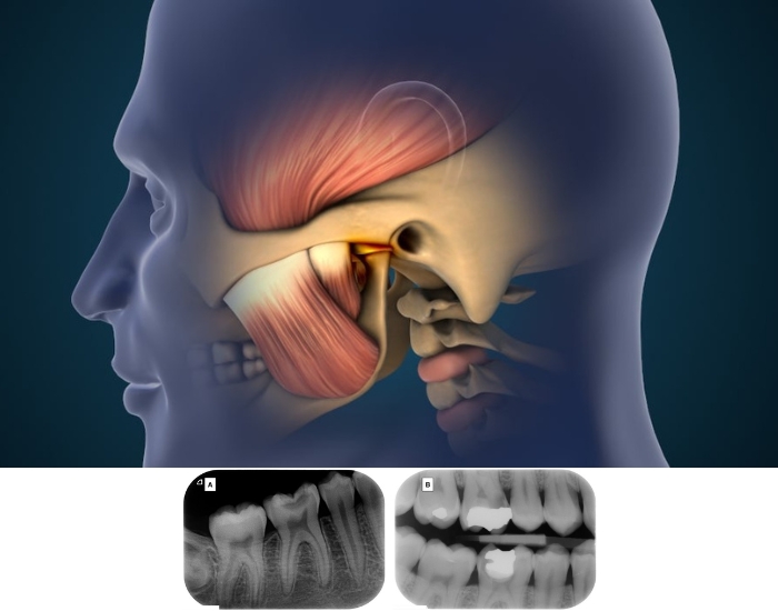 Why My Dentist Found Nothing But My Tooth Still Hurts | Houston Guide