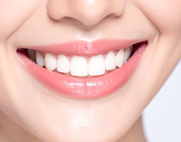 Smile Makeover near me