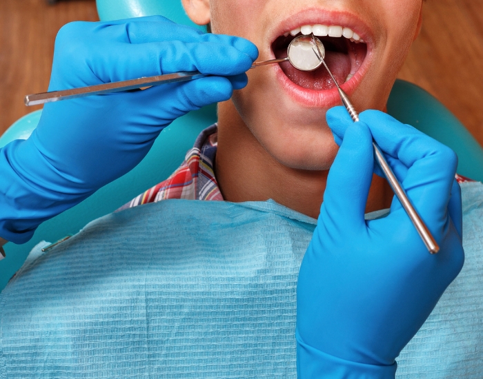 Black Triangles Between Teeth Treatment
